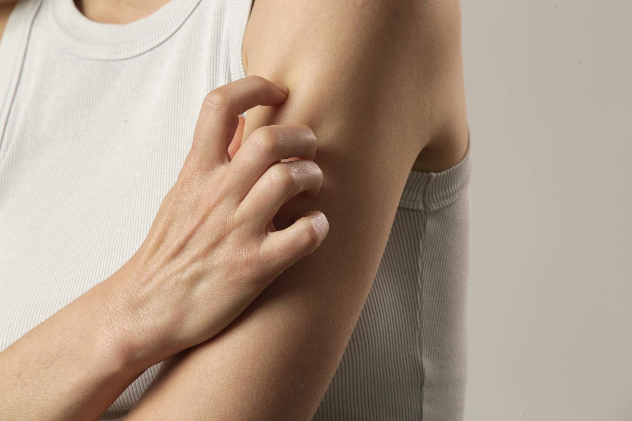 Pain and itching can be early symptoms of shingles.